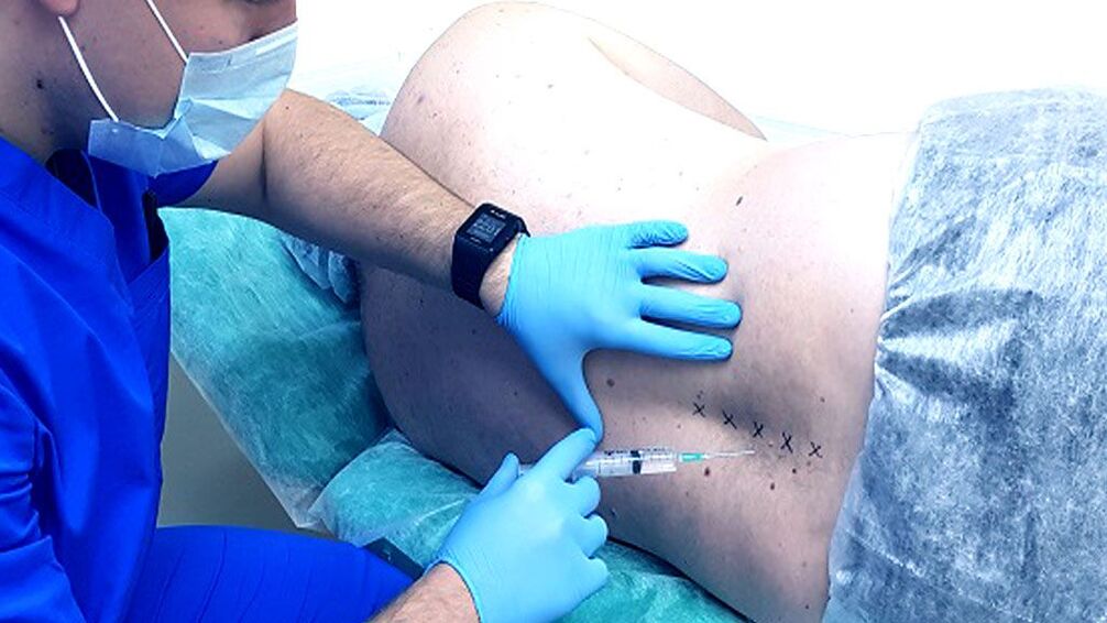 Blok páteře pro osteochondrosu