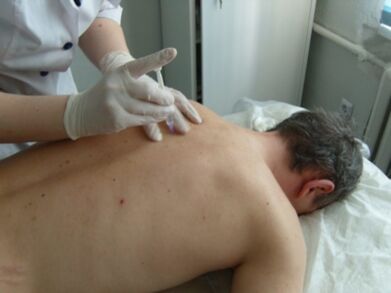 Intraartikulární injekce chondroprotektorů pro hrudní osteochondrózu