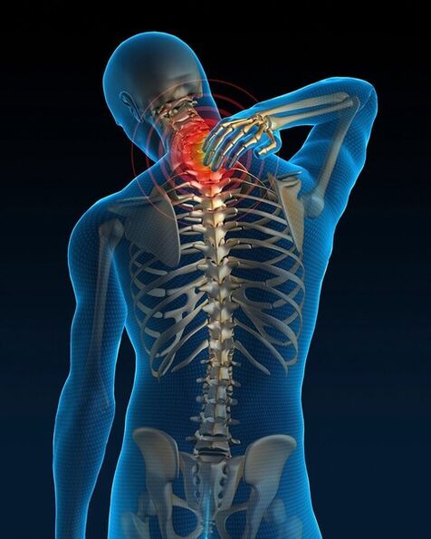 V počáteční fázi léčby cervikální osteochondrózy se bolest v krku zvyšuje